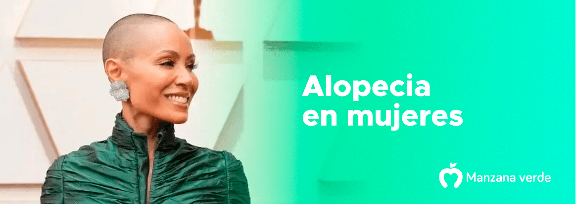 Alopecia femenina